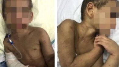 Menino que teve oito costelas e braço quebrados recebe alta do hospital após 27 dias internado