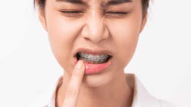 Lesões na boca que não cicatrizam podem ser sinais de câncer