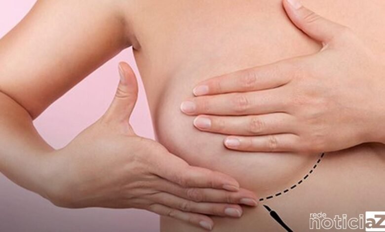 Projeto usa cães para diagnóstico precoce do câncer de mama