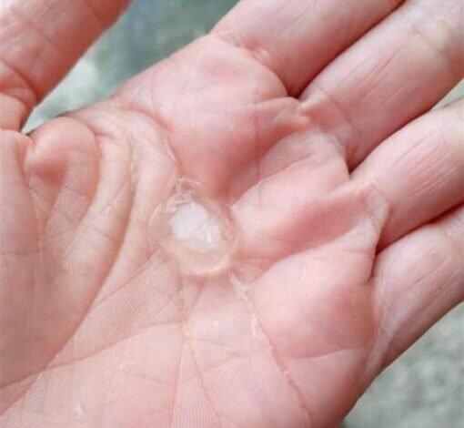 Tempo muda na Baixada Santista e traz chuva de granizo