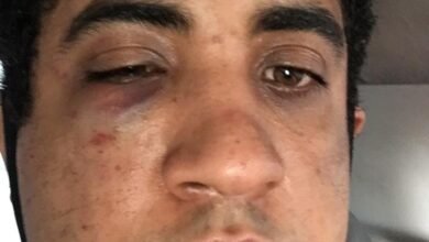 Homem é agredido por frentista em São Vicente