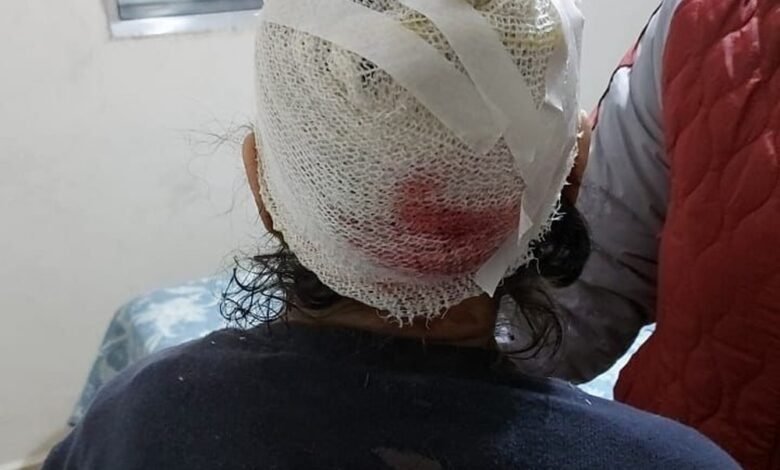 Crueldade! Idosa é assaltada e ainda é esfaqueada em Mongaguá