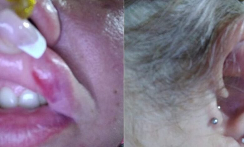 Mulher é agredida por homem em restaurante de Cananéia