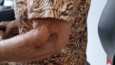 Mulher é presa após ato covarde contra a própria mãe