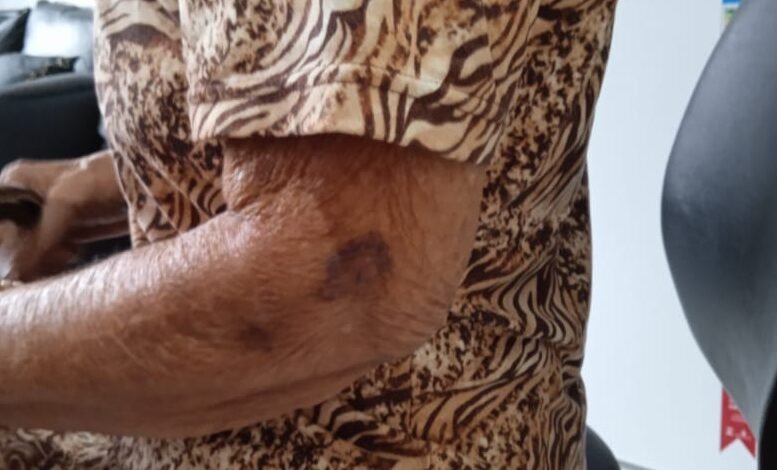 Mulher é presa após ato covarde contra a própria mãe