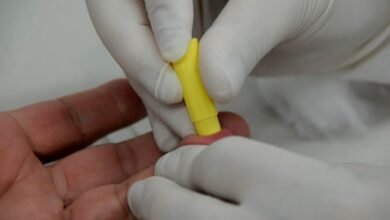 Testes rápidos de HIV e sífilis estão disponíveis em Praia Grande e Santos