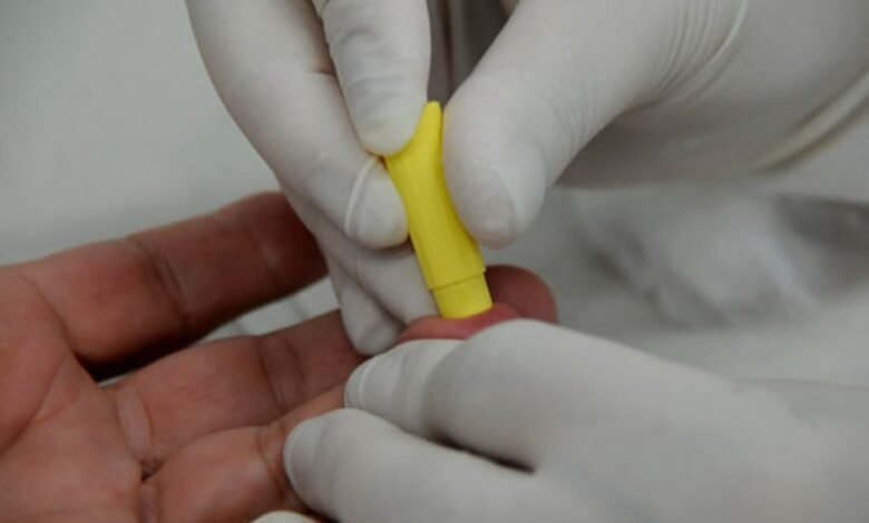 Testes rápidos de HIV e sífilis estão disponíveis em Praia Grande e Santos
