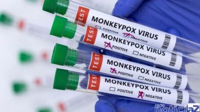 Vinhedo tem casos suspeitos de monkeypox