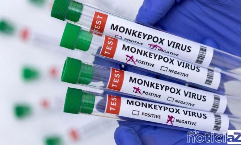 Vinhedo tem casos suspeitos de monkeypox