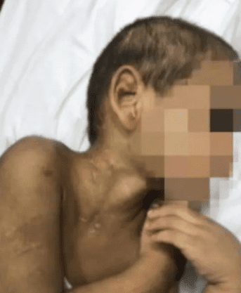 Pai de menino que teve as costas fraturadas em São Vicente garante a guarda provisória