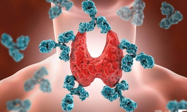 Tireoidite de Hashimoto: doença é um perigo na vida das mulheres