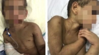 Menino que teve oito costelas e braço quebrados recebe alta do hospital após 27 dias internado