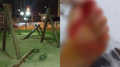 Criança no litoral de SP tem pé dilacerado após madeira de balanço cair em cima