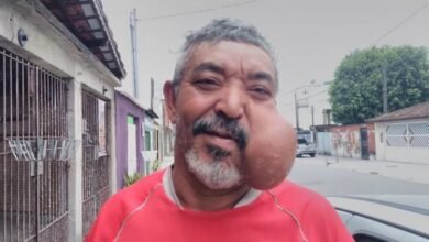 Pedreiro com grande cisto é encontrado morto dentro de casa