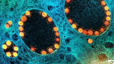 Doze estados registram alta de casos de Covid-19