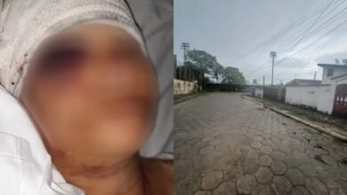 Mulher é atacada por cão pitbull no litoral de SP e fica gravemente ferida