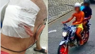 Homem surdo é atingido com diversas coronhadas na cabeça por criminoso e fica ferido no litoral de SP