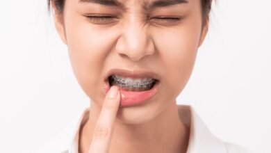 Lesões na boca que não cicatrizam podem ser sinais de câncer