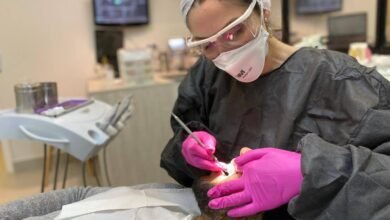 Lente dentária: mais uma moda vinda do BBB 23