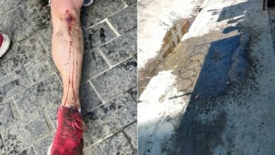 Mulher escorrega em óleo e cai em calçada de Santos