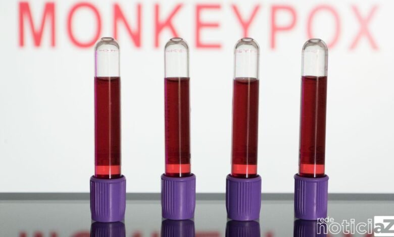 Primeiras vacinas contra varíola dos macacos devem chegar em setembro