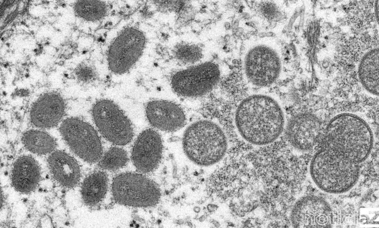 Brasil passa de 200 casos da varíola dos macacos