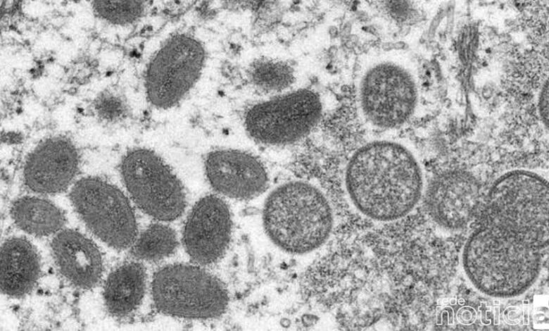 Varíola dos macacos: OMS declara emergência internacional de saúde
