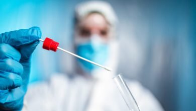 Casos positivos da Covid