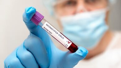 Barretos confirma 2 casos de Varíola dos Macacos e tem 5 em investigação