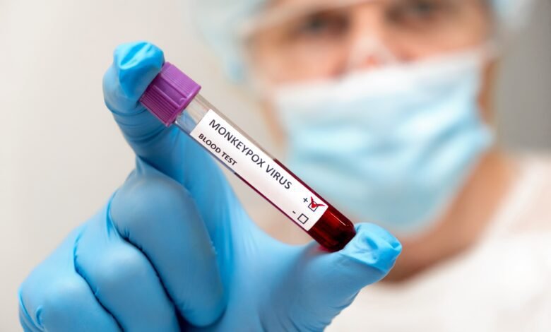 Barretos confirma 2 casos de Varíola dos Macacos e tem 5 em investigação