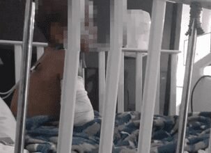Criança que teve oito costelas fraturadas em SP está hospitalizada e MP investiga