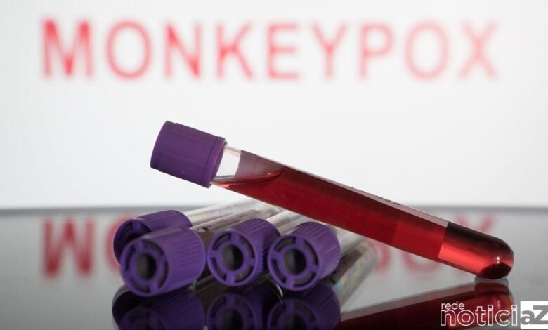 São Paulo registra primeira morte por varíola dos macacos