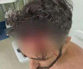 Thiago Rodrigues: Investigações mostram que ator caiu sozinho e não houve assalto