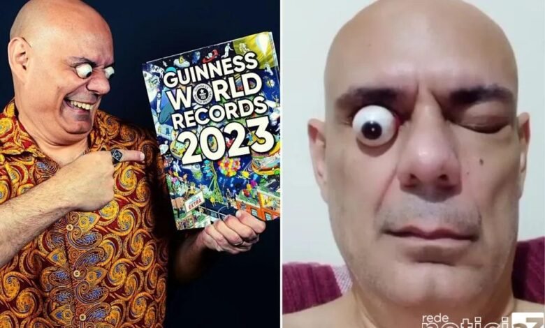 Homem com os olhos mais esbugalhados do mundo é de Santos