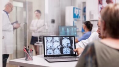 Saiba quais são os sinais de epilepsia e como tratar