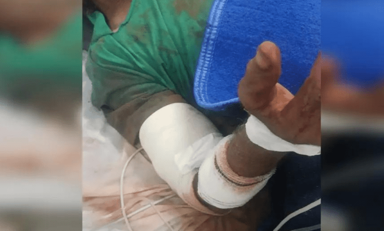 Idoso tem perna amputada após ser atacado por cães