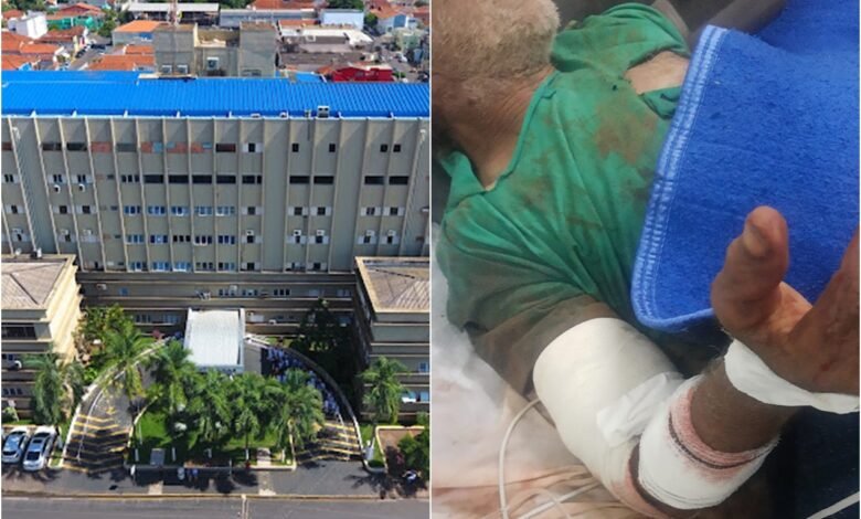 Idoso atacado por cães passa por nova cirurgia