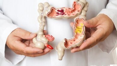 Exames de câncer de colorretal tem apenas 6% de exames realizados