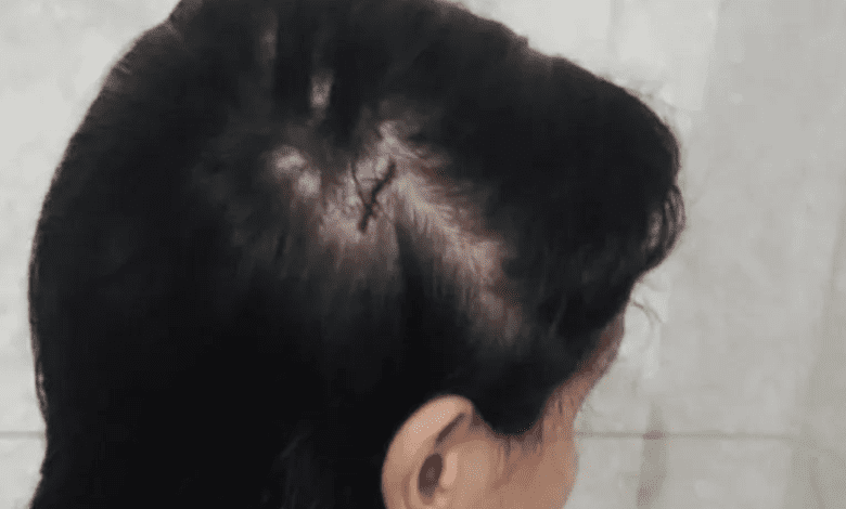 Vereador é investigado por violência doméstica em Severínia