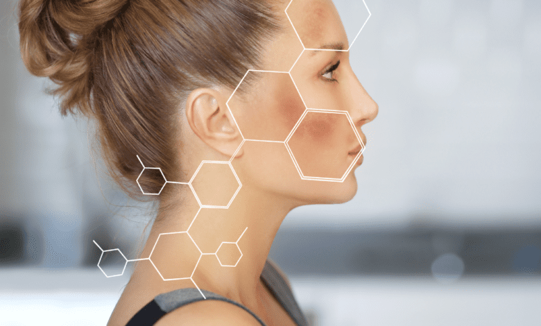 Desenvolveu melasma durante a gravidez? Saiba como amenizar as manchas