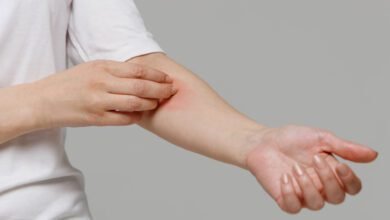 Confira 5 dicas para prevenir as reações alérgicas