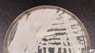 Fiocruz e Pasteur vão pesquisar sobre danos dos fungos no ser humano