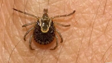 Jundiaí está com sete casos suspeitos de Febre Maculosa