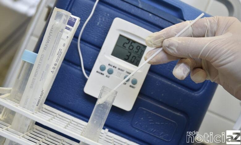 testes ubs são camilo para covid-19