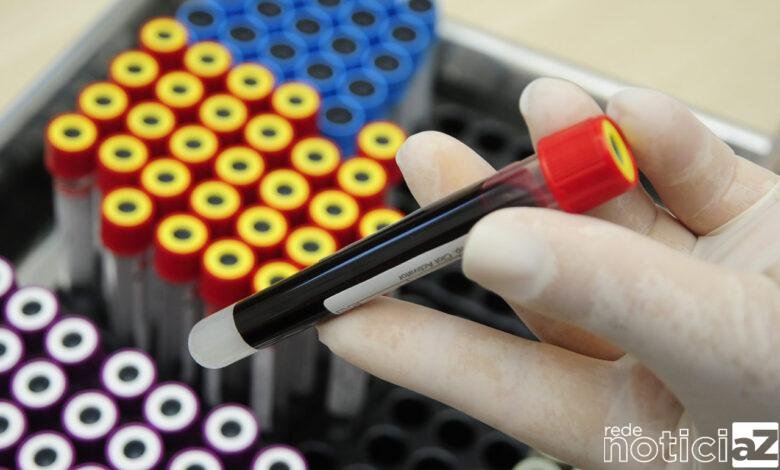 Novembro Azul: UBS dá orientação sobre câncer de próstata