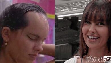 É possível ajustar uma testa grande como a de Thaís do BBB21