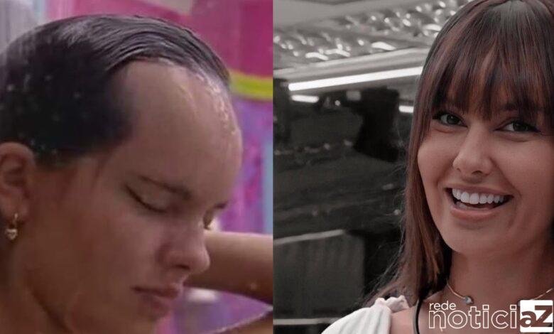 É possível ajustar uma testa grande como a de Thaís do BBB21
