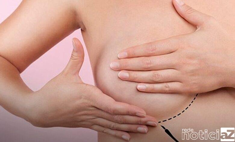 Câncer de mama supera o de pulmão e já é o mais comum no mundo