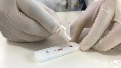 Em um estudo divulgado na plataforma medRxiv, pesquisadores brasileiros deram os primeiros passos para entender por que algumas pessoas são naturalmente