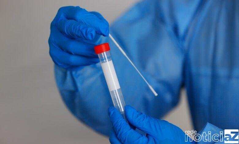 O ministro da Saúde Marcelo Queiroga disse nesta segunda-feira (7) que o protocolo de segurança sanitária para Copa América incluirá testes moleculares